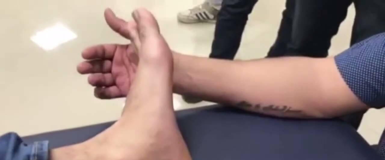 Acute ankle sprain after a fall